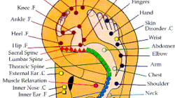 Auricular Community Acupuncture