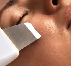 Ultrasonic Exfoliating Treatment