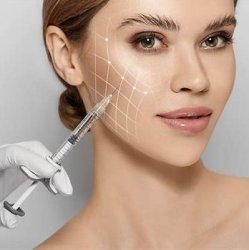Sculptra x 4