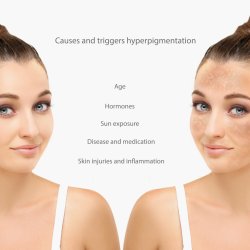 10 Express Facial Session Pass