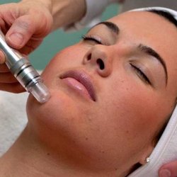 Microdermabrasion