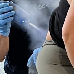 Localized Cyrotherapy (5 pack)