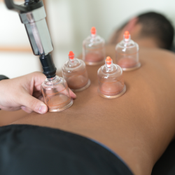 2 Pack 60 Minute Cupping