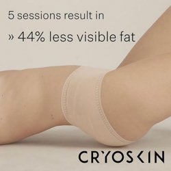 1x CryoSlimming Session