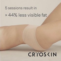 5x CryoSlimming Pass