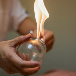 Fire Cupping - 30 minutes