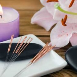 Acupuncture with Qi Gong and Tui Na - 60 min